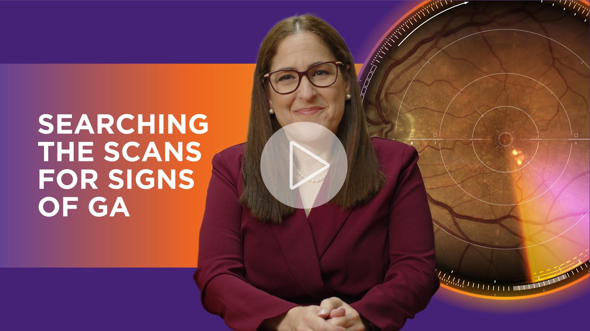 Identifying the GA Diagnostic Biomarkers | Julie Rodman, OD, MSc, FAAO