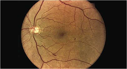 Optometric Management Pentavision Optometric Management Pentavision