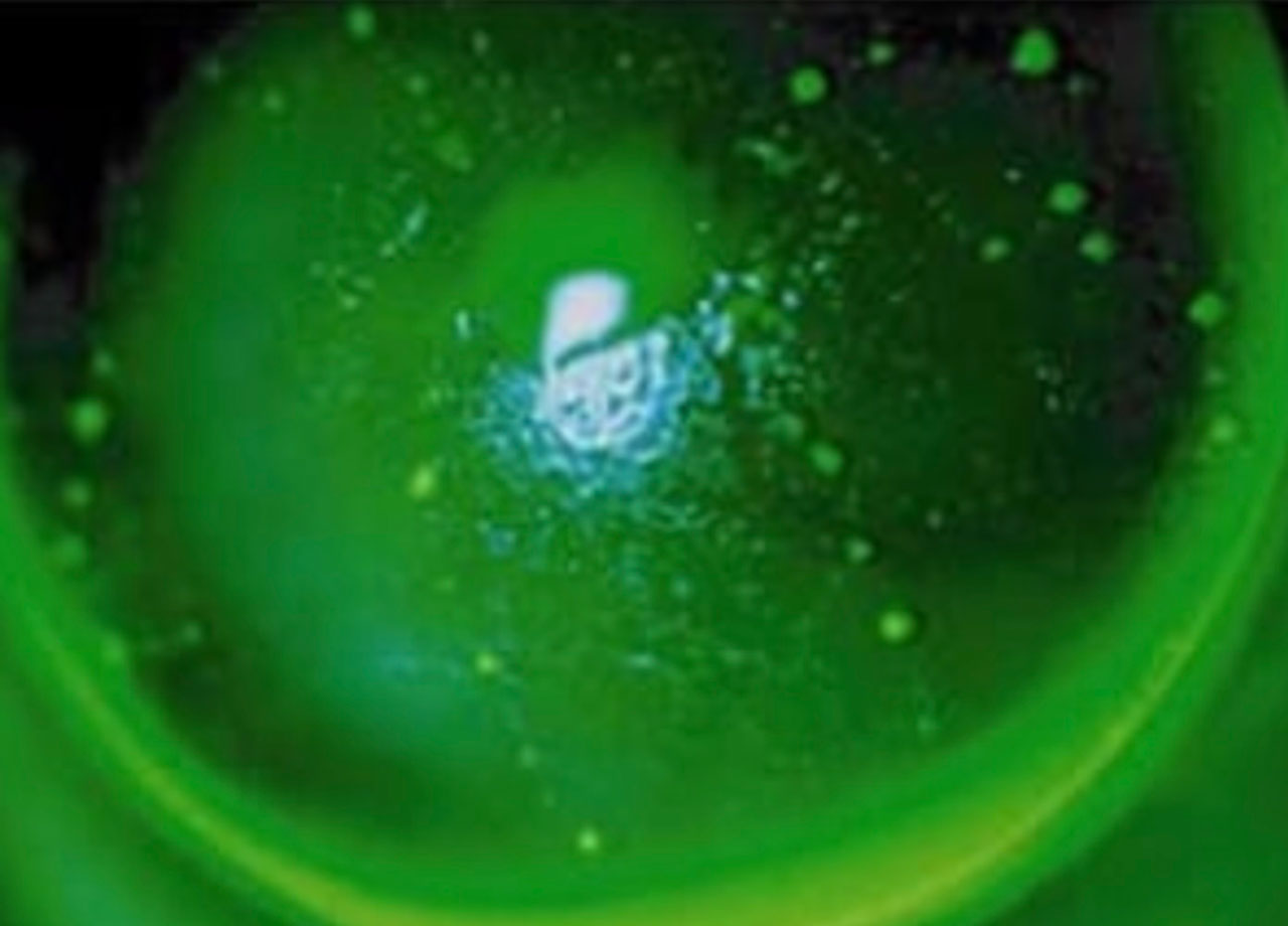 High Riding Rgp Contact Lenses: Selecting RGP Material Properties | Optometric Management